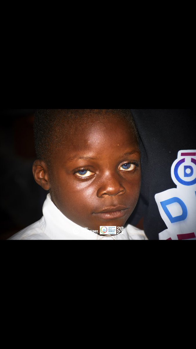 What is with deaf kiddos and blue eyes🥹
One of our very own small feet🥰