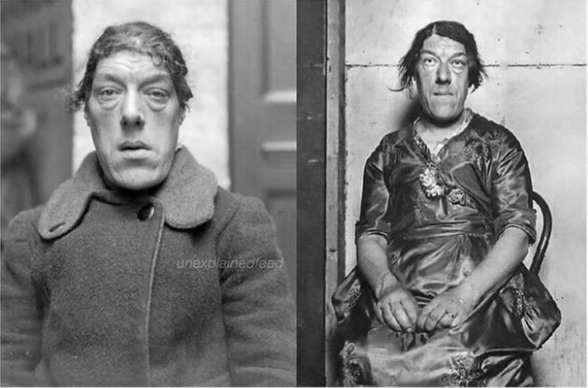 tusmedios's tweet photo. 5. Tras la muerte de su marido y sin el sostén de la casa, Mary Ann Bevan decidió presentarse a un concurso y ganó el ofensivo título de "mujer más fea del mundo" y fue contratada por un circo. Soportó las burlas de los demás para criar a sus hijos y darles una vida mejor. https://t.co/r3Vbxf1Eta