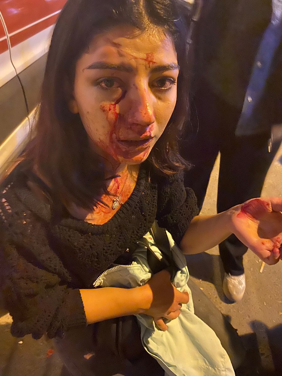 Kadının burnunu kıran Melih denen adam kimin nesi?

Kadın dayaktan ameliyatlık olmuş.

Adam serbest.
Neden?

 #MelihÜnlüer kim?