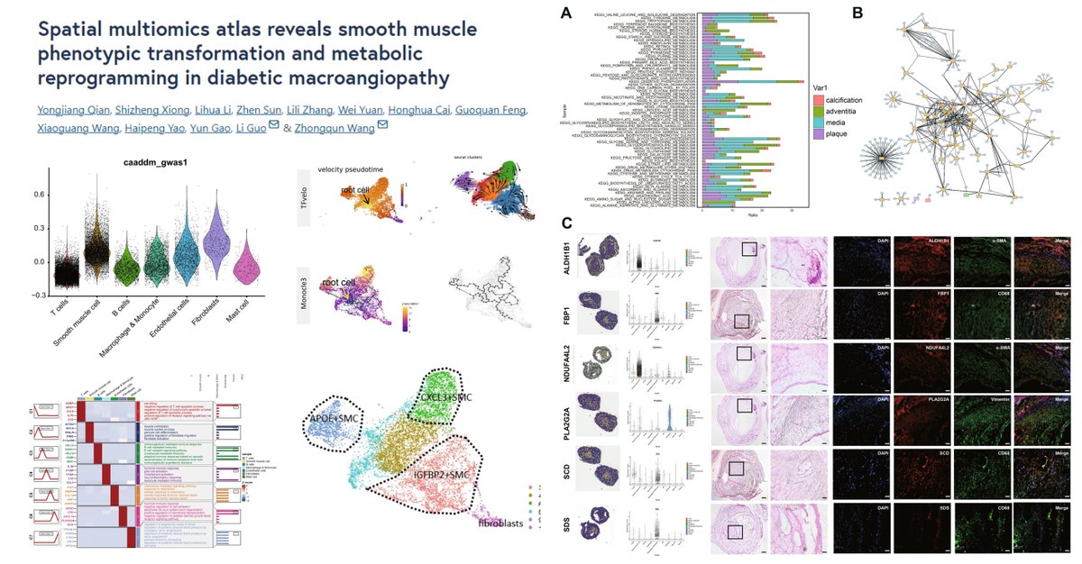 HaoYin20's tweet image. #SpatialOmics #ChronicLimbThreateningIschemia #Diabetes
Anterior Tibial Artery #Amputation
scRNAseq n=4
#SpatialTranscriptomics Visium n=4
#SpatialMetabolomics #ImagingMassSpec n=7
RCTD integrates scRNA with Visium (wish a better interpretation of spatially-resolved arterial…
