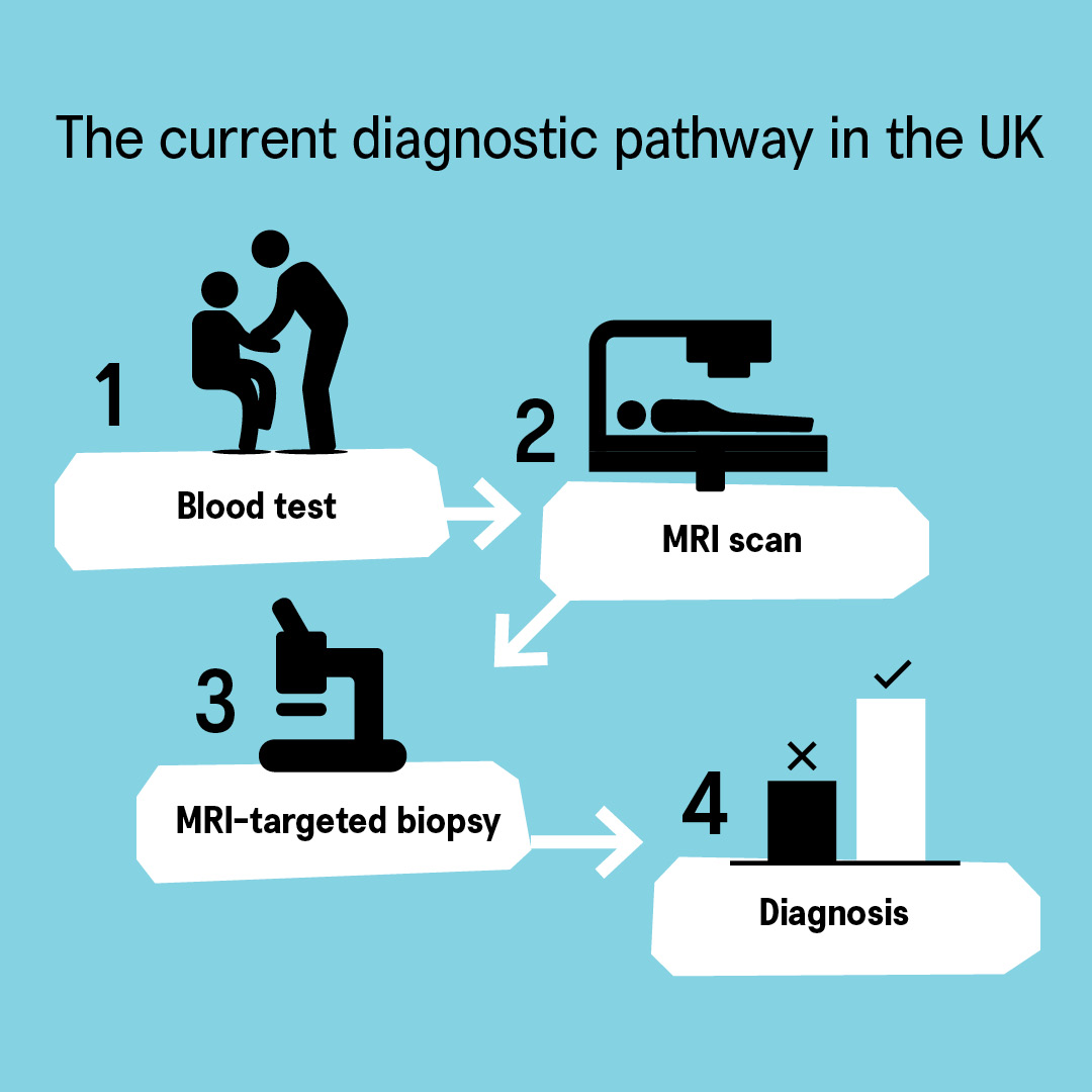 New evidence proves that the way we diagnose prostate cancer is safer for men.

Now we're asking the government to update NHS guidelines so that GPs can proactively discuss the disease and the PSA blood test with men at highest risk.

➡️ Join the campaign: bit.ly/4cNKtLX