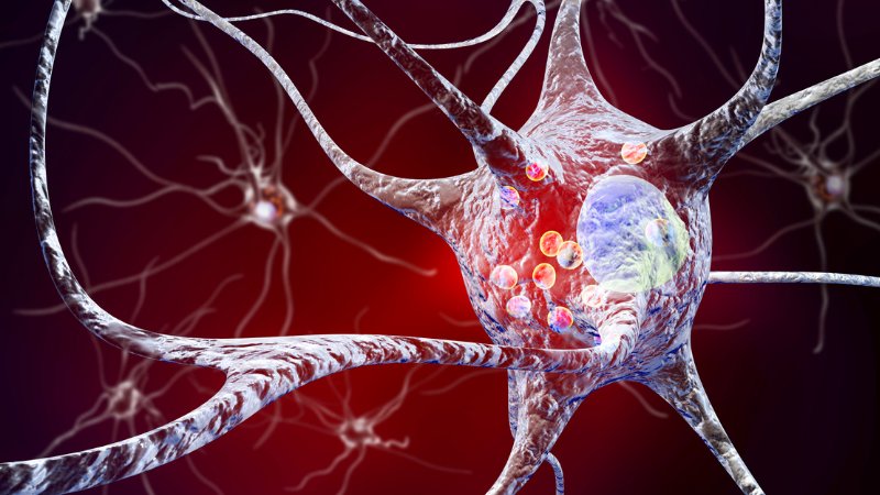 Penn Medicine CSO (@pennmedcso) on Twitter photo .<a href="/PennMedicine/">Penn Medicine</a> researchers receive $18M grant from <a href="/NIH/">NIH</a>/<a href="/NIHAging/">The National Institute on Aging (NIA)</a> to investigate cognitive decline in Lewy body diseases ft. <a href="/alicechenp/">Alice Chen-Plotkin</a>, <a href="/drdirwin/">David Irwin</a> (<a href="/PennNeurology/">University of Pennsylvania Neurology</a>), <a href="/TNRLab/">Eddie Lee</a>, Virginia Lee, Kelvin Luk (<a href="/PennPathLabMed/">Penn Path & Lab Medicine</a>) & Sharon Xie (<a href="/UPennDBEI/">Dept. of Biostatistics, Epidemiology & Informatics</a>) tinyurl.com/4u5b3z7c .<a href="/PennMedicine/">Penn Medicine</a> researchers receive $18M grant from <a href="/NIH/">NIH</a>/<a href="/NIHAging/">The National Institute on Aging (NIA)</a> to investigate cognitive decline in Lewy body diseases ft. <a href="/alicechenp/">Alice Chen-Plotkin</a>, <a href="/drdirwin/">David Irwin</a> (<a href="/PennNeurology/">University of Pennsylvania Neurology</a>), <a href="/TNRLab/">Eddie Lee</a>, Virginia Lee, Kelvin Luk (<a href="/PennPathLabMed/">Penn Path & Lab Medicine</a>) & Sharon Xie (<a href="/UPennDBEI/">Dept. of Biostatistics, Epidemiology & Informatics</a>) tinyurl.com/4u5b3z7c