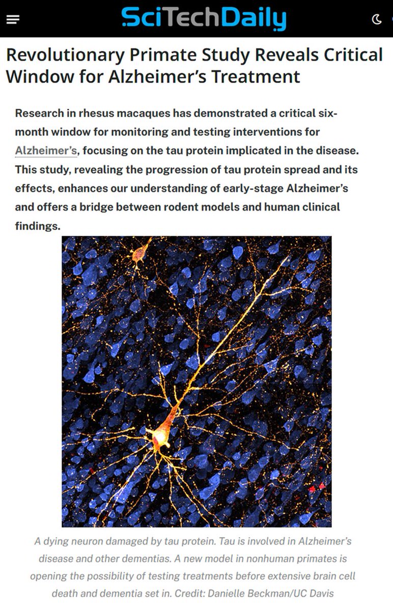 DaniBeckman's tweet image. Good news! Our work describing a new primate model for Alzheimer&apos;s Disease has received over 3,000 views since publication! Read it here  onlinelibrary.wiley.com/doi/10.1002/al… 

#ViewsMilestone
