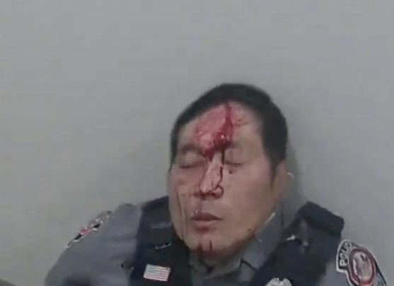 PTSD CLIPS tweet media