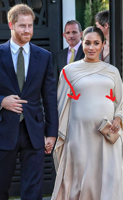 WeeBee333's tweet photo. She is was wearing this type of moon bump.
You can actually see the straps on each side, through that thin fabric.

This woman never gave birth.  And #PrinceHarry was part of the entire fraud on the British people.

#MeghanMarkleIsABully 
#MeghanMarkleisaLiar https://t.co/M6REyZvC54