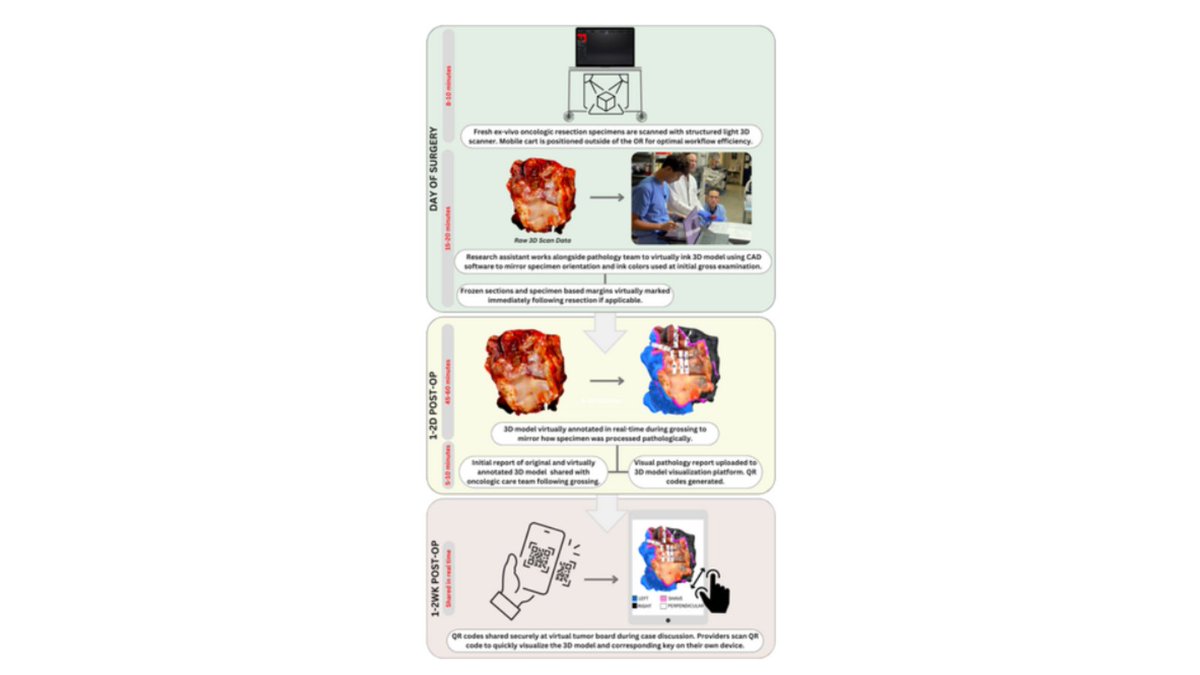 VUMC Otolaryngology–Head and Neck Surgery (@vanderbiltent) on Twitter photo Multidisciplinary tumor boards are vital for complex #HeadAndNeckCancer cases but lack tumor visualization. Visual pathology reports can enhance understanding & improve patient care! #Pathology onlinelibrary.wiley.com/doi/10.1002/he…
<a href="/fassler_carly/">Carly Fassler</a> <a href="/marina_aweeda/">Marina Aweeda</a> <a href="/LockneyNatalie/">Natalie Lockney</a> <a href="/mitra_mehrad/">Mitra Mehrad</a> Multidisciplinary tumor boards are vital for complex #HeadAndNeckCancer cases but lack tumor visualization. Visual pathology reports can enhance understanding & improve patient care! #Pathology onlinelibrary.wiley.com/doi/10.1002/he…
<a href="/fassler_carly/">Carly Fassler</a> <a href="/marina_aweeda/">Marina Aweeda</a> <a href="/LockneyNatalie/">Natalie Lockney</a> <a href="/mitra_mehrad/">Mitra Mehrad</a>