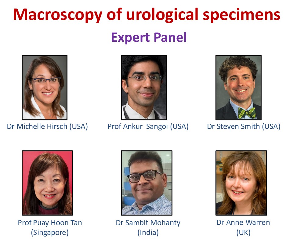 We will be joined by GU experts from UK, USA, Singapore and India who will provide valuable insights into how they approach complex and controversial issues in GU macroscopy.