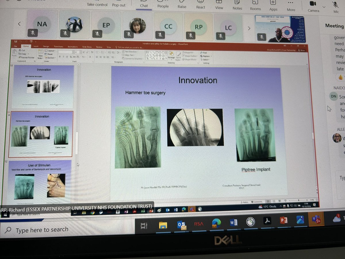 Mobolaji (@bolajilewis) on Twitter photo An enlightening session today hearing Podiatry colleagues #AHPsDay2024 <a href="/EPUTNHS/">EPUT</a> talking quality and safety innovations in podiatric surgery #richardsharp #jason thanks for sharing <a href="/RachelWField/">Rachel Wakefield</a> <a href="/SuzanneRastrick/">Suzanne Rastrick</a> <a href="/AlexGreenNHS/">Alexandra Green</a> <a href="/tolanAHP/">Steve Tolan</a> An enlightening session today hearing Podiatry colleagues #AHPsDay2024 <a href="/EPUTNHS/">EPUT</a> talking quality and safety innovations in podiatric surgery #richardsharp #jason thanks for sharing <a href="/RachelWField/">Rachel Wakefield</a> <a href="/SuzanneRastrick/">Suzanne Rastrick</a> <a href="/AlexGreenNHS/">Alexandra Green</a> <a href="/tolanAHP/">Steve Tolan</a>