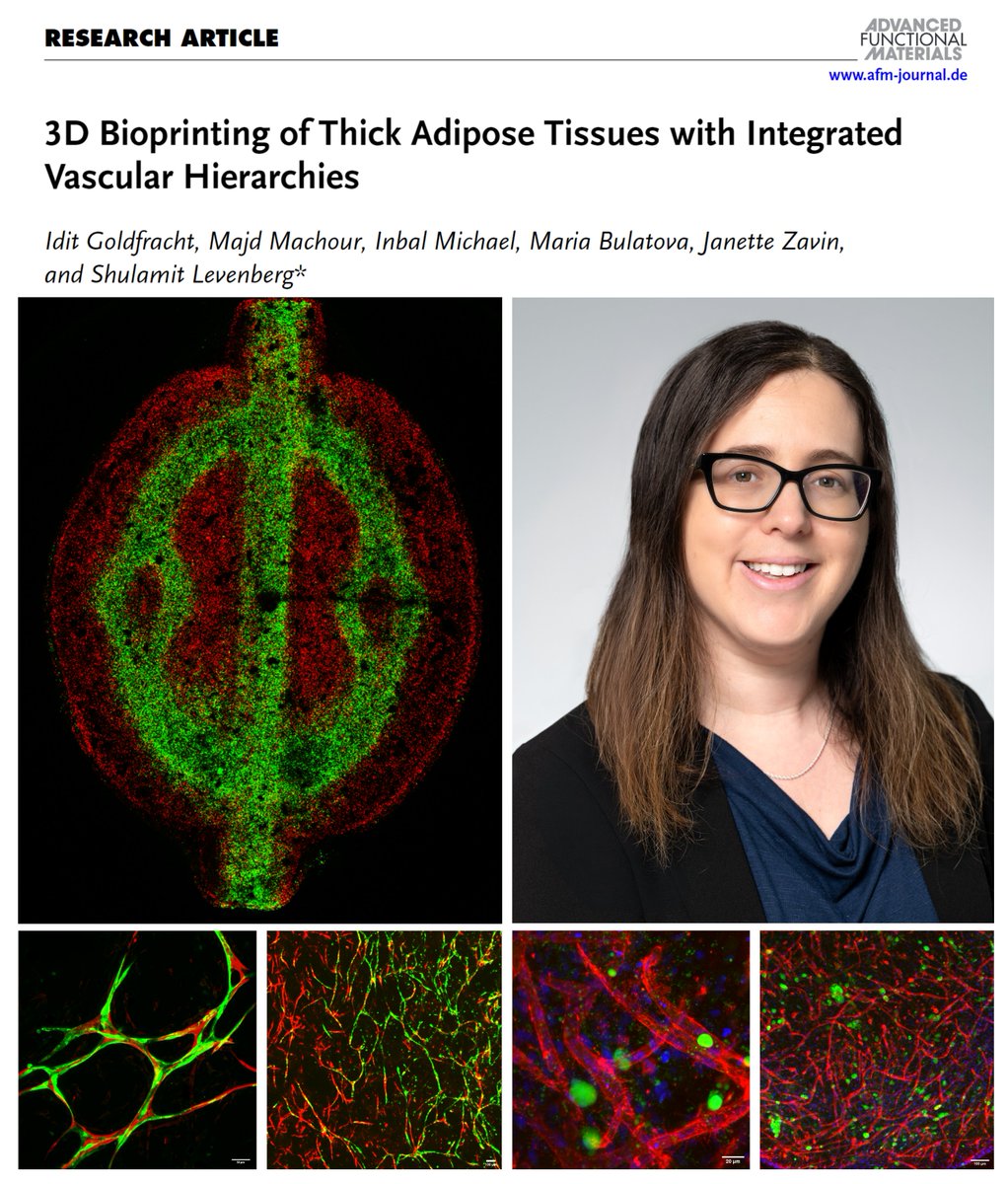 Levenberg Lab (@levenberglab) on Twitter photo Happy to share our latest publication in Advanced Functional Materials <a href="/AdvPortfolio/">Advanced Portfolio News</a>
Read here: lnkd.in/dzdG6-hf
#3DBioprinting #TissueEngineering #RegenerativeMedicine #Vascularization Happy to share our latest publication in Advanced Functional Materials <a href="/AdvPortfolio/">Advanced Portfolio News</a>
Read here: lnkd.in/dzdG6-hf
#3DBioprinting #TissueEngineering #RegenerativeMedicine #Vascularization