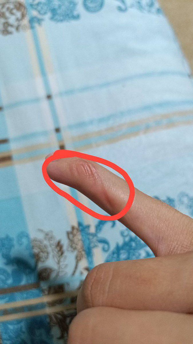 Yüzümüz gülsün artık sayın <a href="/drmemisoglu/">Prof. Dr. Kemal Memişoğlu</a> 
#MemişoğluAcilAtama