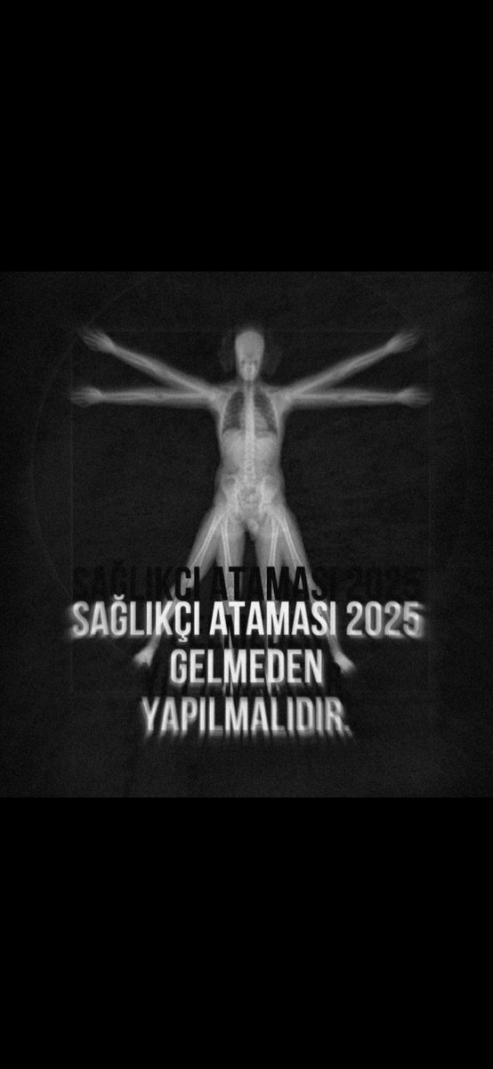 hllmtll1's tweet photo. Bir an önce bu sessizlik son bulmalı ve sağlık camiasının yararına olacak şekilde istenilen ve gerekli alımlar yapılmalıdır.

Radyoloji 5 bin 
#MemişoğluAcilAtama https://t.co/qmrA1uJIZM