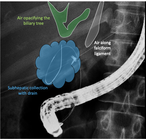 Sahaj Rathi MD, DM, MRCP tweet media