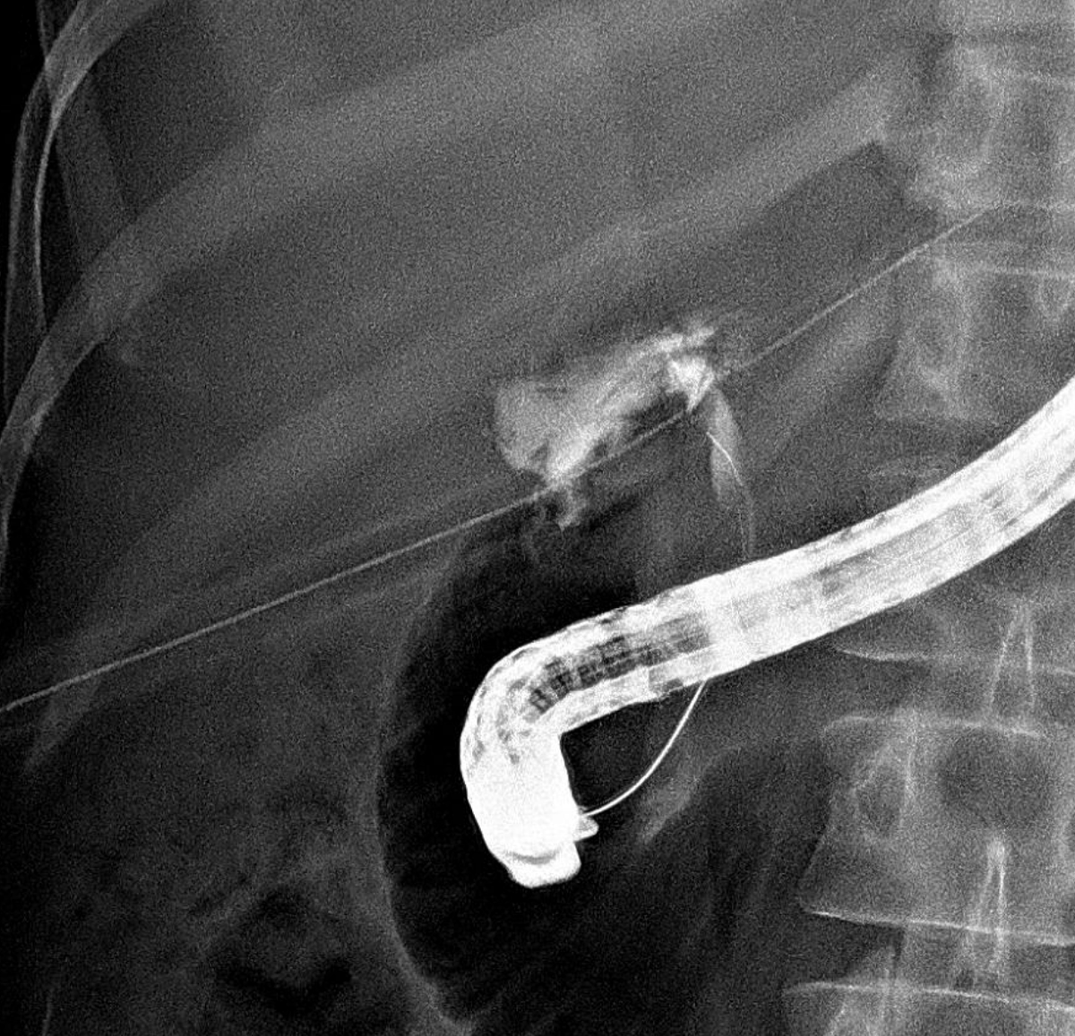 Sahaj Rathi MD, DM, MRCP tweet media