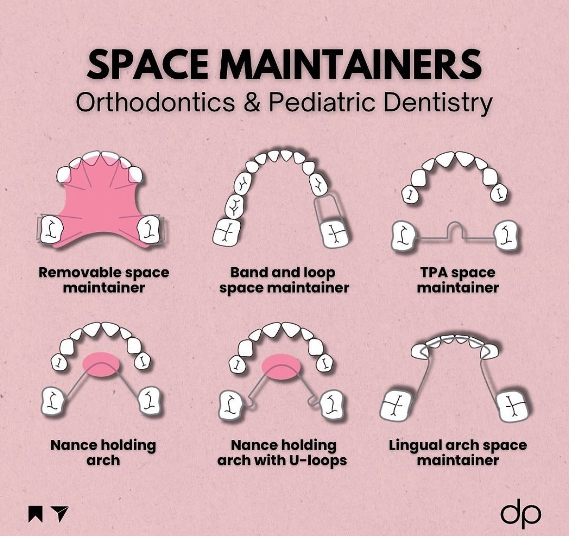 DiariesDent's tweet photo. Space maintainers 📚 https://t.co/1PGLY293Fp