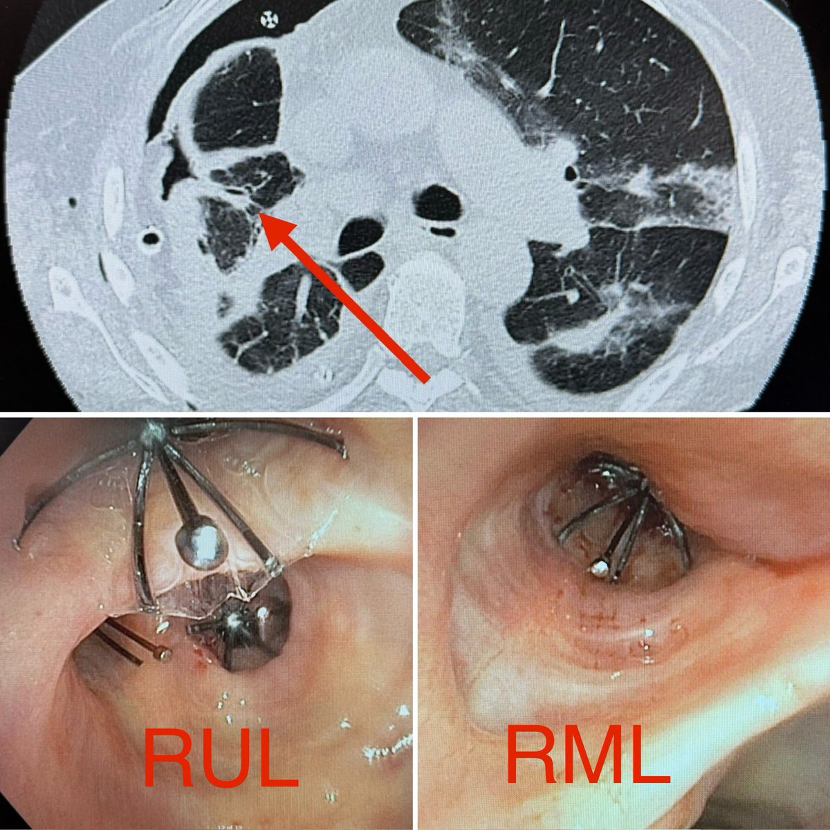 Ali Abedi MD FCCP DAABIP tweet media