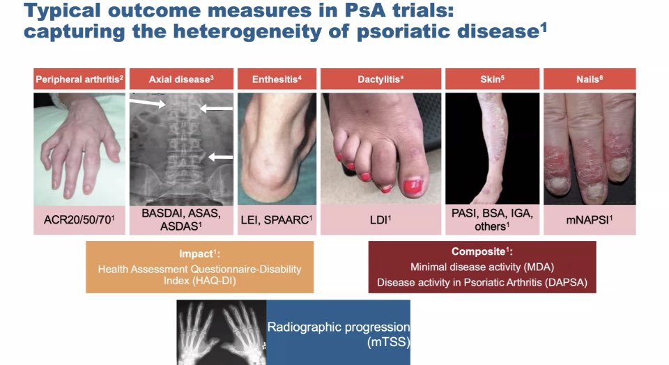 UTSWRheum tweet media