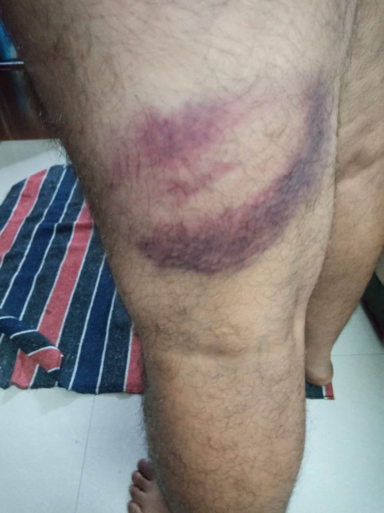 Mahesh00064841's tweet photo. **अतिथि शिक्षकों को  नौकरियों के बदले लाठियां क्या यही अच्छे दिन हैं, फर्जी राष्ट्रवाद और धर्म का चोला  पहने लोगों को क्या इसी लिए सत्ता सौंपी थी**🔥🔥🔥असली देशभक्त और सच्चे हिन्दू इस कुशासन का विरोध करें🔥🔥🔥 https://t.co/Jqn46DI7sK