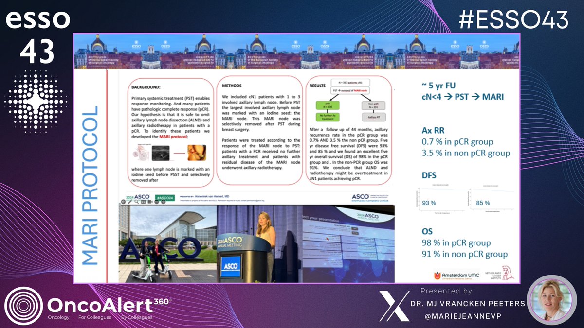 OncoAlert's tweet photo. The @OncoAlert 🚨Coverage #ESSO43 DAY TWO

Choose wisely: TAD or SLN for axillary surgery after NAC 
Speaker: M.J. Vrancken Peeters🇳🇱@mariejeannevp 

"I will discuss  that it is time to change our approach when thinking about axillary treatment in patients with breast cancer with nodal involvement. The benefit of an axillary lymph node dissection is more and more discussable, and showed not be used as staging procedure.”

@itrisabel 🇪🇸
@KarakatsanisA 🇸🇪
@WimCeelen 🇧🇪
@DeliaCortesGuir 🇪🇸
@AndreasBrandl8 🇩🇪
@OlofssonBagge 🇸🇪
@EdiBonci 🇷🇴
@LauraLorenzonMD 🇮🇹
@martajimenez135 🇪🇸
@SStattner 🇦🇹
@SochorovaDana 🇨🇿
@GabrielleVanRam 🇧🇪
@weoncologists 🇺🇸
@ESSOnews

@asgbi @BASO_ACS @SurgeryWomen
@SOS_Pk @ASiTofficial @Cerrahi_Onko
@sbco_oficial @SFCOnco @operarelcancer
@PTCHOpl @EYSAC1 @YoungSurgeonsAT
@junge_chirurgie @YSAC_PK