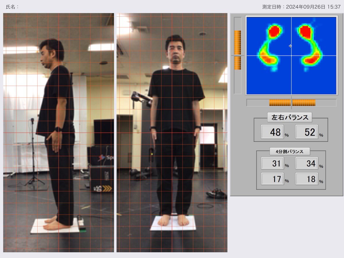【アスリートも一般人も】
スポーツの競技力向上において、トレーニングによる強化は大切ですが、そもそも体のバランスが崩れていては、うまくパフォーマンスも発揮できませんし、怪我のリスクも高まります。