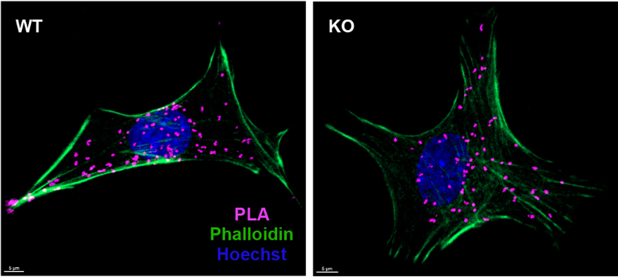 J_Cell_Sci's tweet photo. .@DestinyFSchultz, David Katzmann and colleagues @mayoclinicbmb find that loss of HD-PTP function results in lipodystrophy, defective cellular signalling and altered lipid homeostasis.
https://t.co/mDcZohcKSZ https://t.co/fGOtDzWPCA