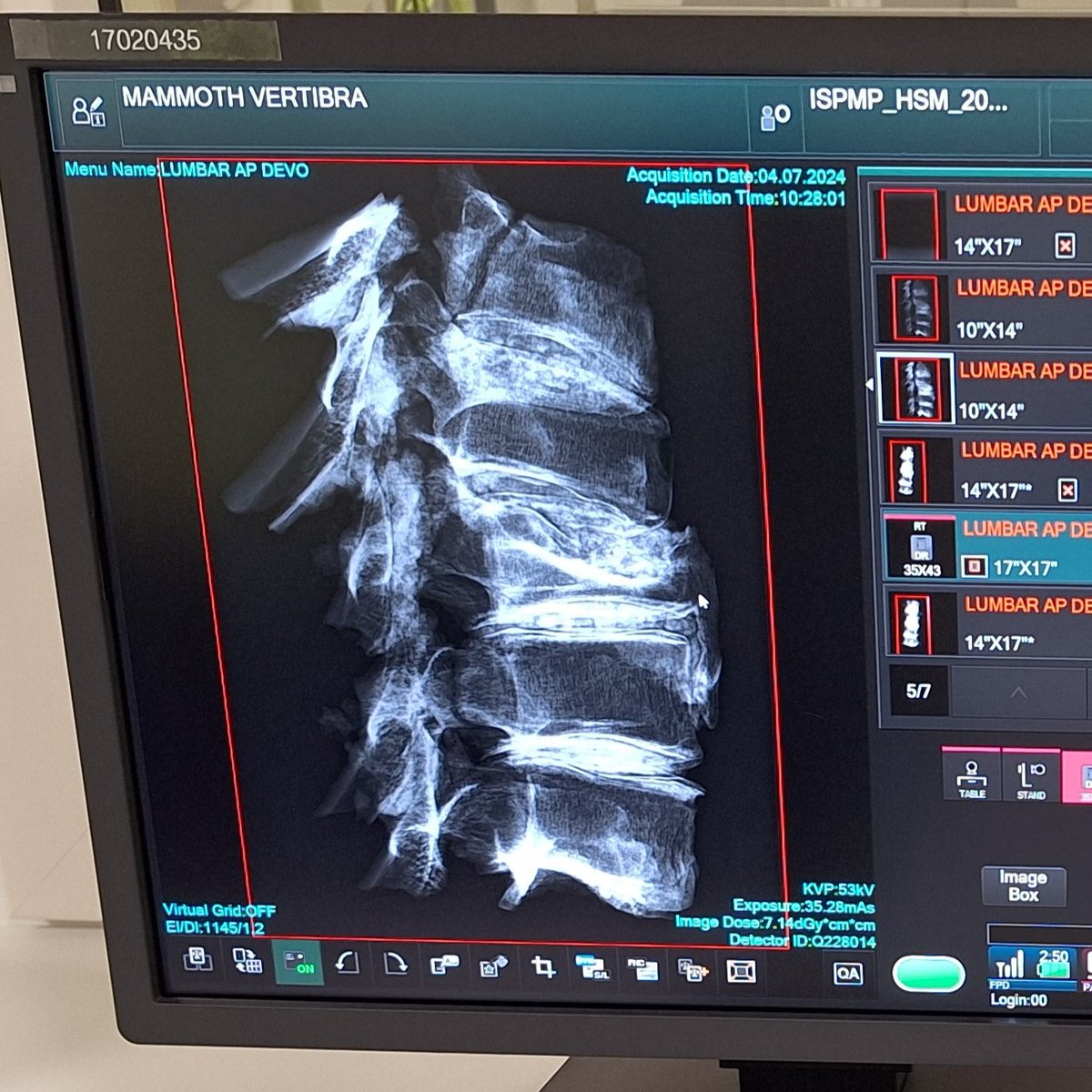 UniofSuffolk's tweet photo. 😮 Our Diagnostic Radiography team recently joined forces with Colchester + Ipswich Museums Service to X-ray historical items, revealing secrets up to 200,000 years old!

Find out more about their discovery: https://t.co/UiKjKT6W4j

#HelloSuffolk #UniOfSuffolk https://t.co/KgH4kG9nfp