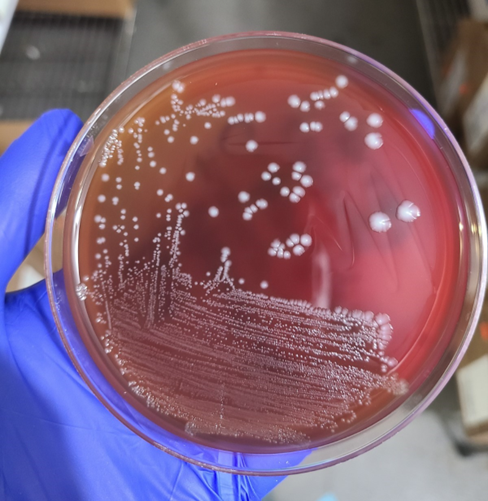 Microbiology Case Study: Not all Gram-Positive Bacilli from Positive Blood Cultures are Contaminants. A 78 year old woman was transferred from a nursing home to the Emergency Room because of delirium and worsening bilateral chronic foul-smelling hip wounds...