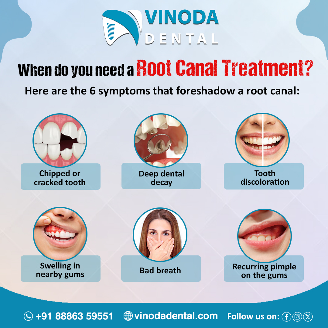 VinodaDental's tweet image. Are you experiencing #badbreath, #crackedteeth, #dentaldecay, #discoloration, or #gumswelling? These could be signs you need a root canal. Visit #VinodaDental for expert, painless #rootcanaltreatment and to save your natural teeth

vinodadental.com/appointment
𝟖𝟖𝟖𝟔𝟑 𝟓𝟗𝟓𝟓𝟏