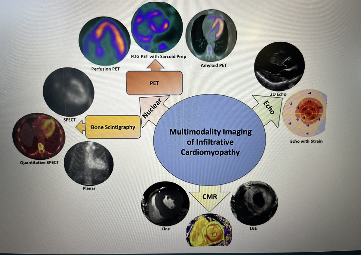 EmmanuelAndrou1's tweet image. Fantastic #MPD2024 Congress in Athens!
The annual meeting of the #ESCWorkingGroup on Myocardial & Pericardial Diseases!
♦️Updates on #MMI in Infiltrative Cardiomyopathy-what’s New?♦️
#cardiotwitter
#CardioEd #ESCardioEd #EscYoung #MPD2024
@KingsCollegeNHS
@StGeorgesUni