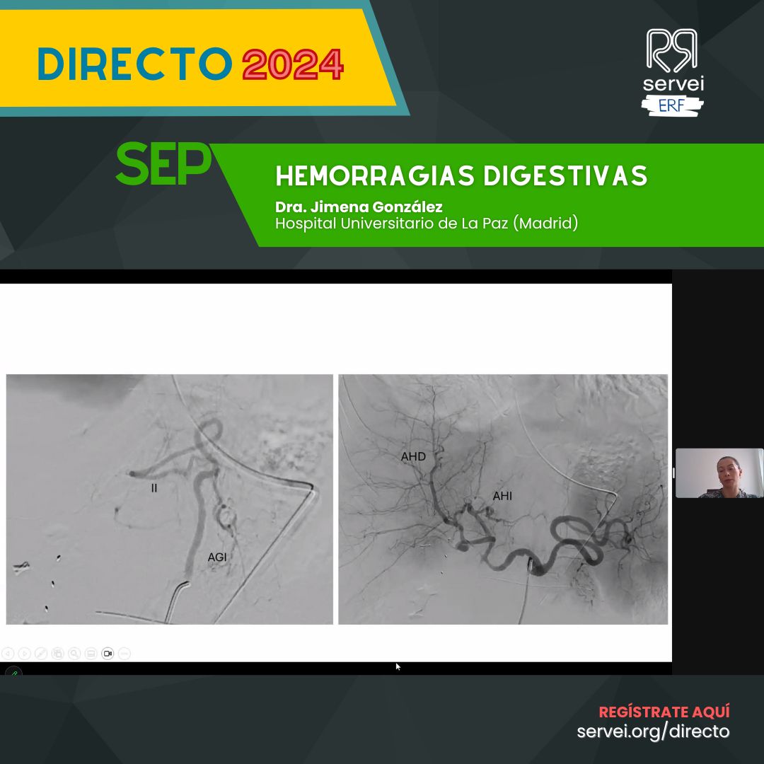 🤪 Para todos aquellos despistados que se perdieron este fantástico webinar o los que quieran repasar algún truco...

¡Ya está disponible el vídeo 📽️ en nuestro canal de YouTube!

Urgencias en RVI ⬇️
youtu.be/CTf0D4dhWZA

#RadiologíaIntervencionista #IRad