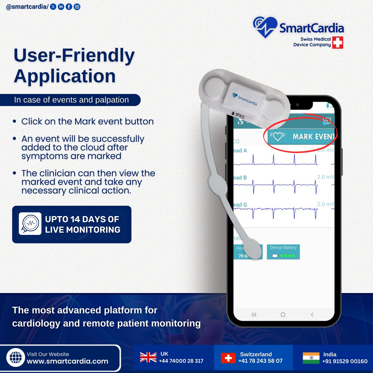 Track events and palpitations with SmartCardia 7L ECG Patch. Marking events is as easy as clicking the Mark Event button. Clinical data is securely stored on the cloud, allowing clinicians to review and take necessary actions for patient care.

 smartcardia.com

#ecg
