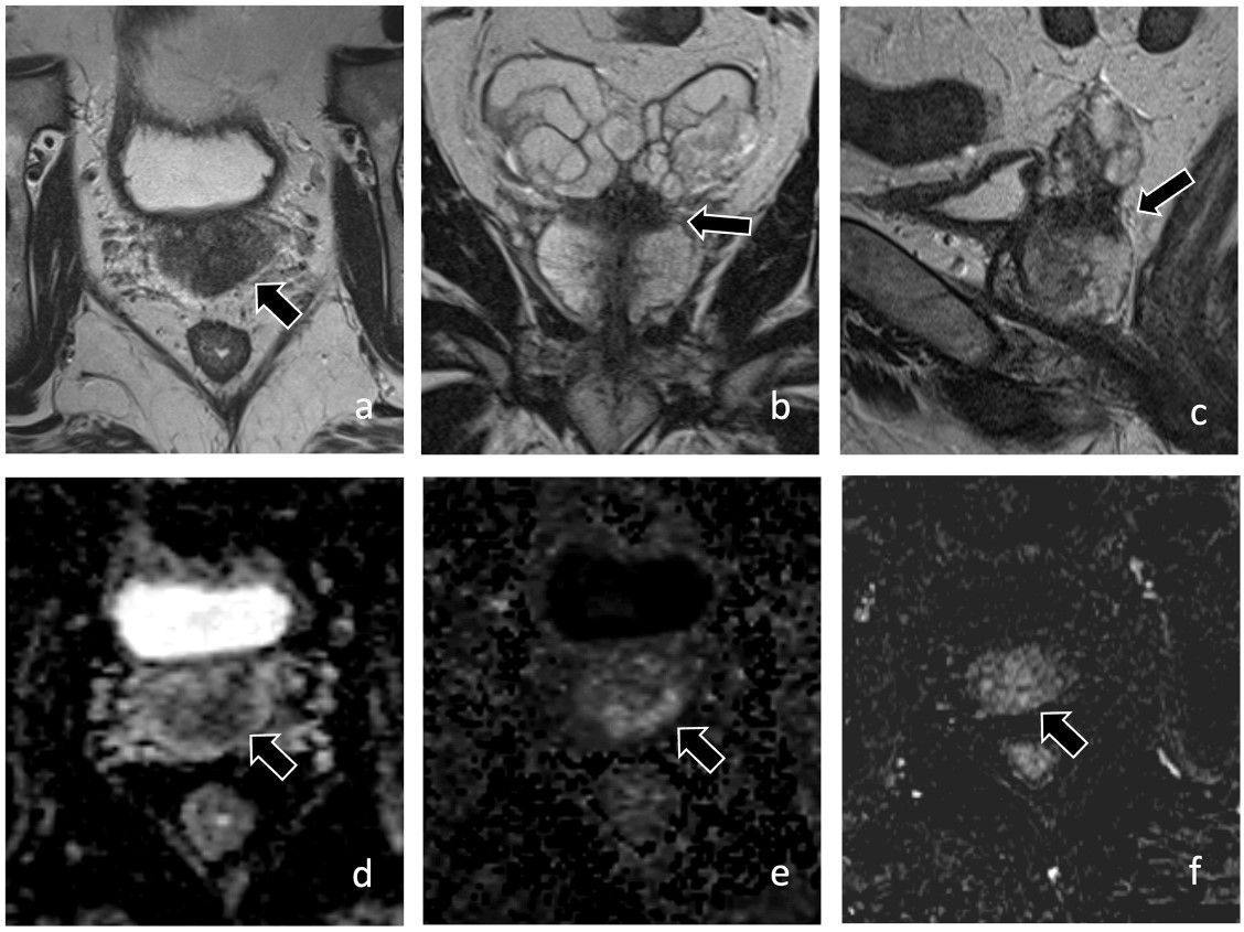 ESR Journals tweet media