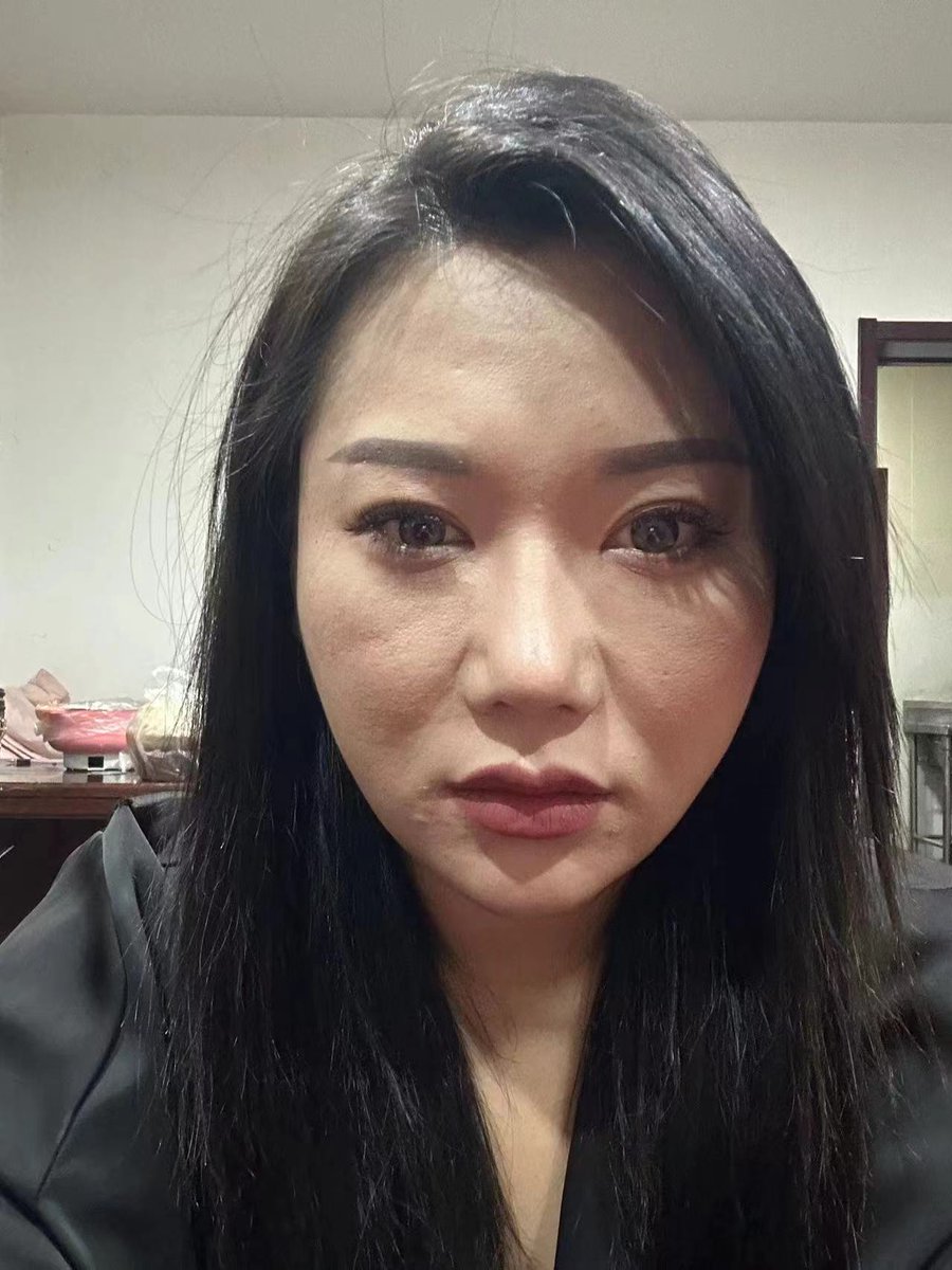 Visagiste999's tweet photo. #plastic surgery
#rhinoplasty
#oculoplastic
#鼻整形
#眼综合 https://t.co/sPUpTg58tD