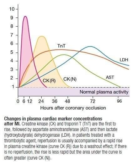 ZHeart11768530's tweet photo. 🔴CARDIAC BIOMARKERS: MEMORY TRICKS⤵️
   🔹 Myoglobin
   🔹 CK-MB
   🔹 CK
   🔹 Trop T
   🔹 AST
   🔹 LDH
⏳ Their rise, peak &amp; return to normal levels in attached 📊📈 &amp; table 👇 !

#Diagnosis #Cardiology #ECG #EKG #Cardiology #FOAMed #MedEd #medstudent #paramedic https://t.co/OLwLZPKW2r