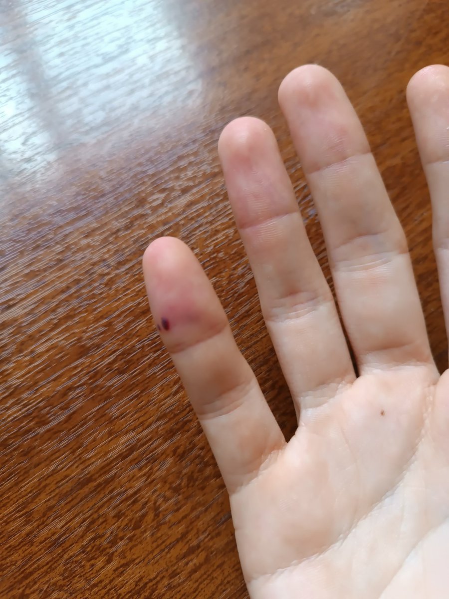 ⳕ ⳑ ⳑ ⳙ ⲉ ⲕ🔻🇵🇸 tweet media