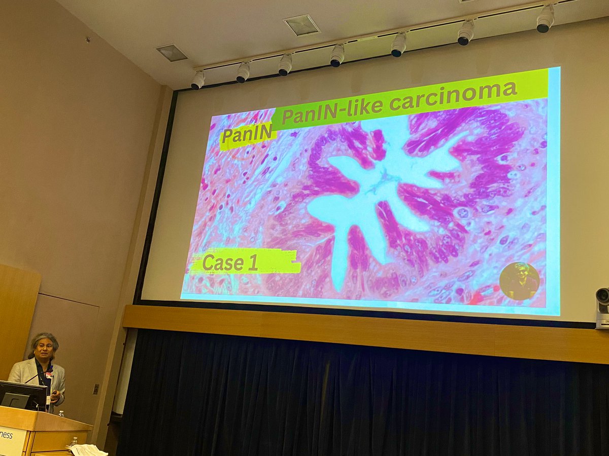 Lisha Wang, MD, PhD (@lishawang9) on Twitter photo Location, location, location 🤯🤯🤯 by Dr. Deshpande <a href="/Mvgs1706/">Monika Vyas</a> <a href="/Vik_deshpandeMD/">Vikram Deshpande</a> <a href="/BIDMCpath/">BIDMC Pathology</a> #FIGHP2024 Location, location, location 🤯🤯🤯 by Dr. Deshpande <a href="/Mvgs1706/">Monika Vyas</a> <a href="/Vik_deshpandeMD/">Vikram Deshpande</a> <a href="/BIDMCpath/">BIDMC Pathology</a> #FIGHP2024