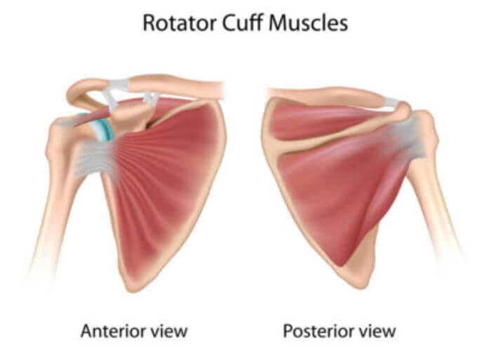 DrJeffPadalecki's tweet photo. Ever wonder how we treat rotator cuff tendonitis? Dr. Padalecki breaks down the treatment process from conservative care to surgical solutions. Let’s get your shoulder back to peak performance! https://t.co/5SIEII3cks #ShoulderCare #OrthopedicEducation https://t.co/pHHVCaQgp6