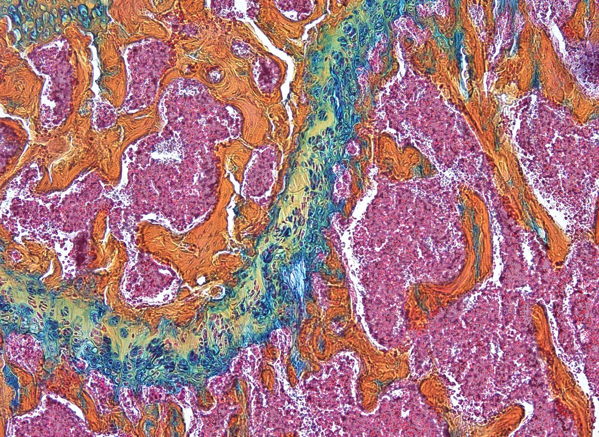 For #FRACTUREFRIDAY 🦴🥳 the beautiful metaphysis of a 🐭bone. 💚Growth plate (cartilage) 💛trabecular bone 🩷 bone marrow #orthotwitter #regeneration #bone #stemcell #womeninSTEM #devbio #lablife #research <a href="/nyulangoneortho/">NYU Langone Orthopedics</a> <a href="/nyulangone/">NYU Langone Health</a> <a href="/PhilippLeuchtMD/">Philipp Leucht, MD</a>