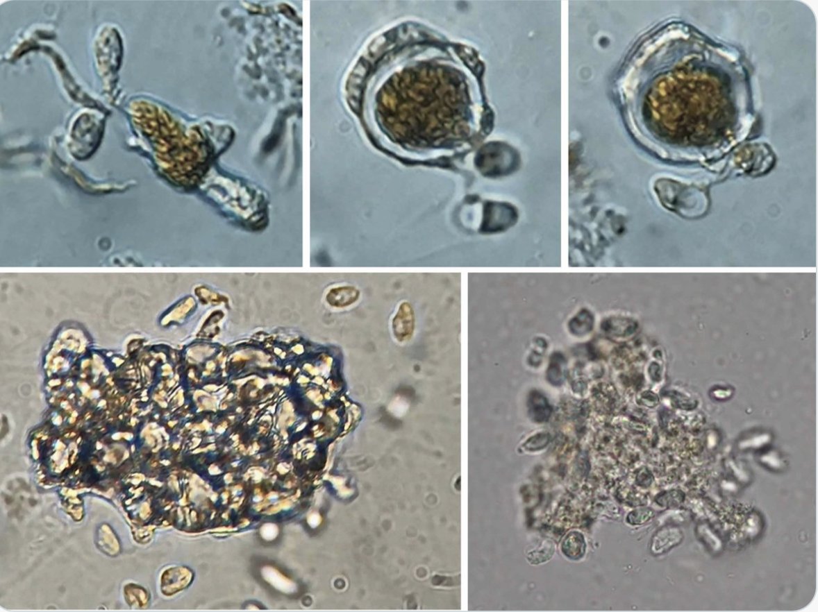 multicellgenome's tweet image. More exciting news in the world of #protists! 🦠🔬 Five new genera and species of Pirsoniales. This study reveals new diversity, offers evolutionary insights, and, for the first time, shows aggregation behavior in these organisms!!!! I love to see #aggregation in more and more…
