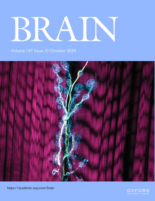 Brain tweet media