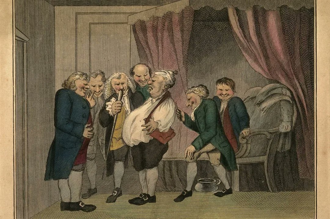 Maps_oddities's tweet image. المرض العرقي كان داءً غامضًا ظهر في إنجلترا بين عامي 1485 و1551، واقتصر تقريبًا على إصابة الرجال الأثرياء في سن الثلاثينيات والأربعينيات. كان يودي بحياة المصابين في غضون ساعات قليلة من ظهور الأعراض، ويُعد واحدًا من أغرب الأمراض في التاريخ.