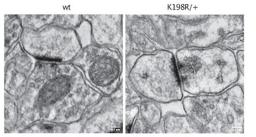 Inserm Paris 5 Ipnp (@insermu1266) on Twitter photo A new study Cruz-Gamero et al. by the team of H. Rebholz <a href="/neurosignaling/">heike rebholz</a> <a href="/Insermu1266/">Inserm Paris 5 Ipnp</a> describes synaptic and behavioral deficits of the first mouse model of OCNDS, a neurodevelopmental/ASD disorder. Congrats!
<a href="/InsermIDF/">Inserm Île-de-France</a> <a href="/GhuParis/">GHU Paris Psy-Neuro</a> #Autism
rdcu.be/dV07C A new study Cruz-Gamero et al. by the team of H. Rebholz <a href="/neurosignaling/">heike rebholz</a> <a href="/Insermu1266/">Inserm Paris 5 Ipnp</a> describes synaptic and behavioral deficits of the first mouse model of OCNDS, a neurodevelopmental/ASD disorder. Congrats!
<a href="/InsermIDF/">Inserm Île-de-France</a> <a href="/GhuParis/">GHU Paris Psy-Neuro</a> #Autism
rdcu.be/dV07C