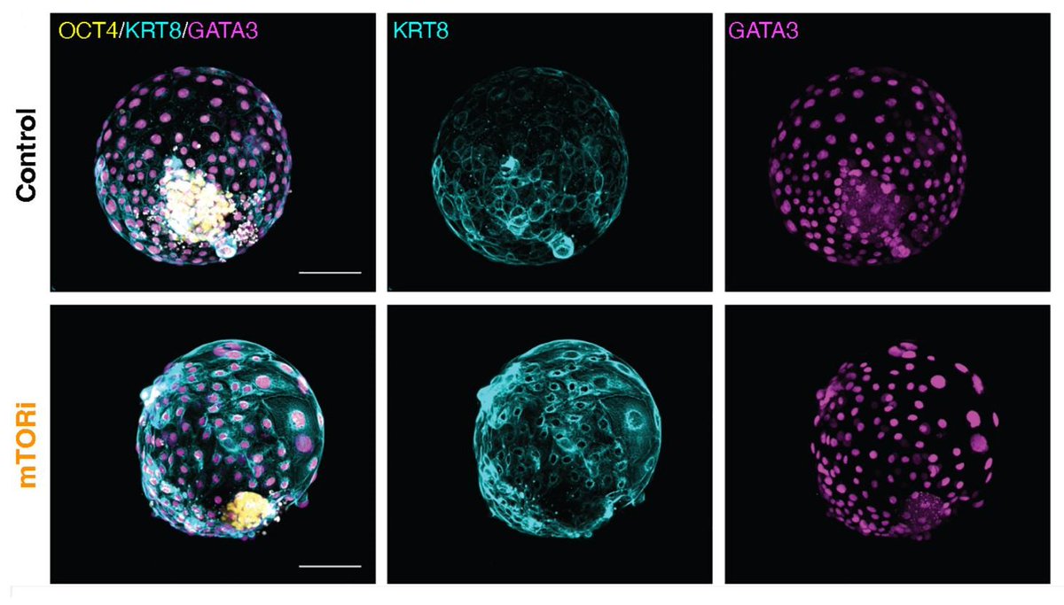 Stem Cell Podcast (@stemcellpodcast) on Twitter photo #Oct4 is #PluripotencyDay, and a great day to check out work from Drs. Aydan @BulutKarslioglu's and Nicolas Rivron's (<a href="/NRivron/">Nicolas Rivron</a>) labs!
⏸️ Dhanur Iyer and Dr. Heidar Heidari Khoei inhibited #mTOR to pause blastoid development.
📔 bit.ly/47Qa8Tu
🎧 bit.ly/47RuXhn #Oct4 is #PluripotencyDay, and a great day to check out work from Drs. Aydan @BulutKarslioglu's and Nicolas Rivron's (<a href="/NRivron/">Nicolas Rivron</a>) labs!
⏸️ Dhanur Iyer and Dr. Heidar Heidari Khoei inhibited #mTOR to pause blastoid development.
📔 bit.ly/47Qa8Tu
🎧 bit.ly/47RuXhn