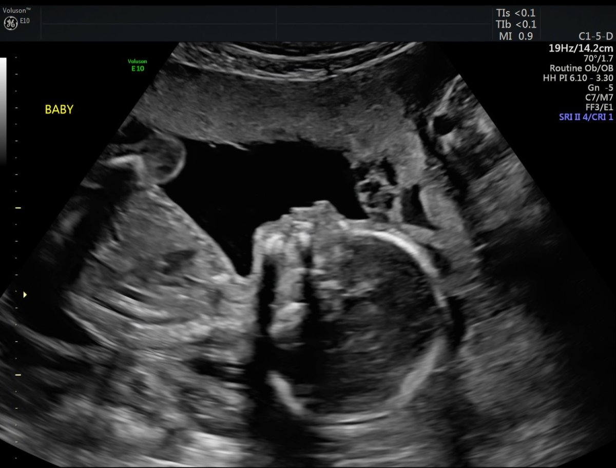 Becky - Live Laugh Lorcana tweet media