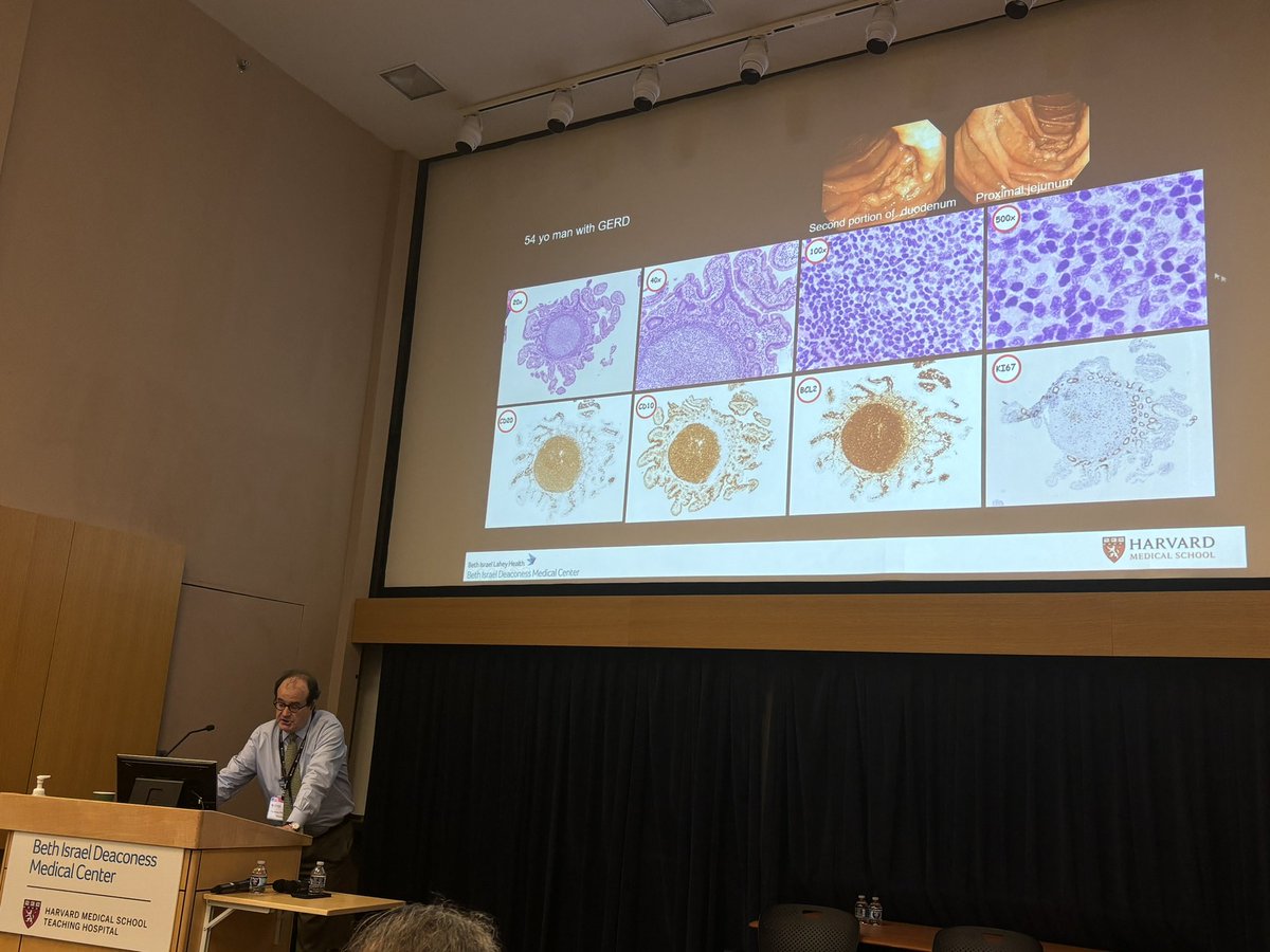 Feidi Chen (@dianachenfd) on Twitter photo Cute duodenal-type follicular lymphoma 😻 No treatment needed—it’s so indolent—Sharing wisdom from our hematopathologist, Dr. Pihan #FIGHP2024 <a href="/BIDMCpath/">BIDMC Pathology</a> Cute duodenal-type follicular lymphoma 😻 No treatment needed—it’s so indolent—Sharing wisdom from our hematopathologist, Dr. Pihan #FIGHP2024 <a href="/BIDMCpath/">BIDMC Pathology</a>