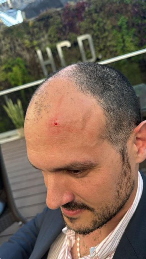 Martin Menem (@menemmartin) on Twitter photo Un grupo de violentos impidieron que <a href="/agustinromm/">Agustín Romo</a> <a href="/AleCiroAlvarez/">Alejandro Alvarez</a> y <a href="/Turios/">Santiago Santurio 🇦🇷</a> pudieran expresarse en la Universidad de la Plata. Este último recibió un piedrazo en la cabeza. Repudio lo ocurrido.
Claramente hay intereses políticos que no quieren discutir la educación Un grupo de violentos impidieron que <a href="/agustinromm/">Agustín Romo</a> <a href="/AleCiroAlvarez/">Alejandro Alvarez</a> y <a href="/Turios/">Santiago Santurio 🇦🇷</a> pudieran expresarse en la Universidad de la Plata. Este último recibió un piedrazo en la cabeza. Repudio lo ocurrido.
Claramente hay intereses políticos que no quieren discutir la educación