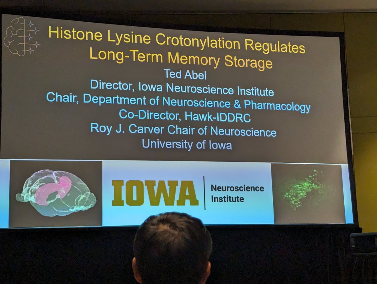 MCCStweets's tweet image. New insights into the epigenetic mechanisms of long-term memory formation via histone lysine crotonylation from @TedAbelneuro at
@uiowa
#MCCS24