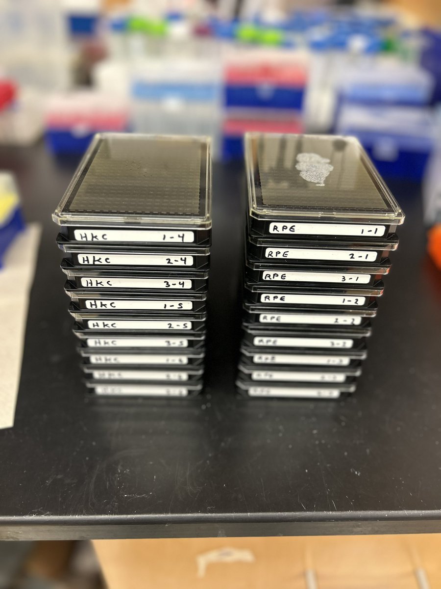 Abid Khan (@abidkhanepigen) on Twitter photo Just wrapped up imaging 18x 384 well plates for of an siRNA screen. Thanks to <a href="/UNC_Lineberger/">UNC Lineberger</a> Developmental Award program for supporting this study. Now on to the fun part āprocessing and analyzing the images! <a href="/DrBrianStrahl/">Dr. Brian D. Strahl</a> <a href="/UNC_BCBP/">UNC Biochemistry and Biophysics department</a> Just wrapped up imaging 18x 384 well plates for of an siRNA screen. Thanks to <a href="/UNC_Lineberger/">UNC Lineberger</a> Developmental Award program for supporting this study. Now on to the fun part āprocessing and analyzing the images! <a href="/DrBrianStrahl/">Dr. Brian D. Strahl</a> <a href="/UNC_BCBP/">UNC Biochemistry and Biophysics department</a>
