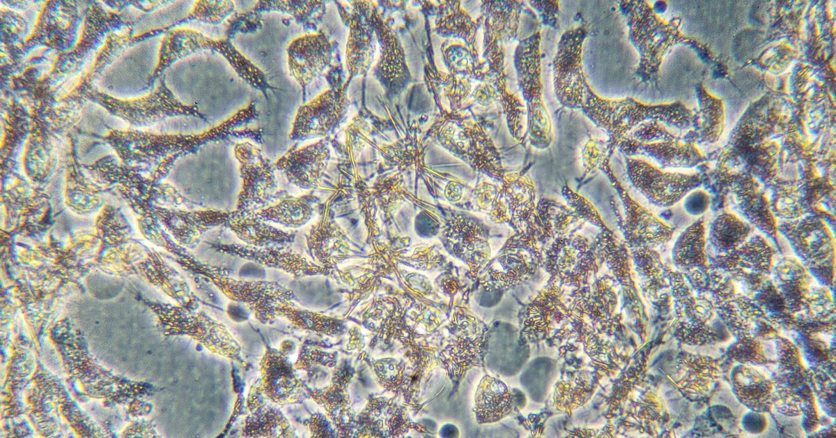 UC San Diego Health Moores Cancer Center (@ucsdcancer) on Twitter photo MCC's Dr. Jill Mesirov is a senior author in the October <a href="/CD_AACR/">Cancer Discovery</a> issue, for her research on transforming cancer research through informatics.🎗️
Discover how software tools for cancer research are essential to the entire field: bit.ly/4gThv0z. 🔬 MCC's Dr. Jill Mesirov is a senior author in the October <a href="/CD_AACR/">Cancer Discovery</a> issue, for her research on transforming cancer research through informatics.🎗️
Discover how software tools for cancer research are essential to the entire field: bit.ly/4gThv0z. 🔬