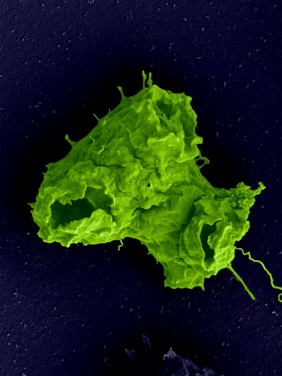 For night 4 of #31NightsofHalloween #MicrosCreepy, here is a scary alien! Or, an amoeba imaged by Scanning Electron Microscreepy.