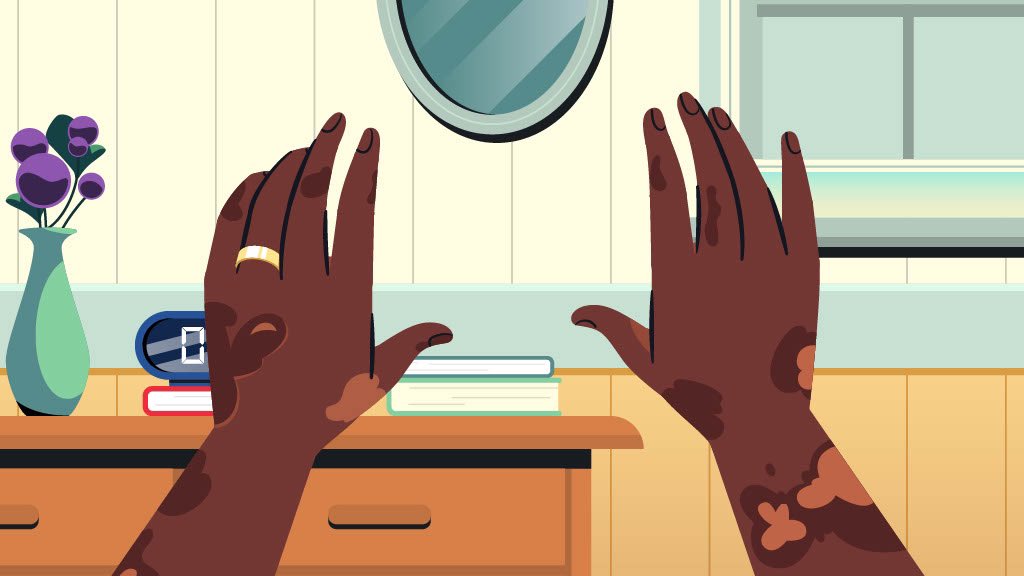 All the toxic chemicals in the skin-lightening products associate with hormone issues, cancer, neurological issues and other mental health problems. Encourage individuals to embrace their skin color &amp; identity.